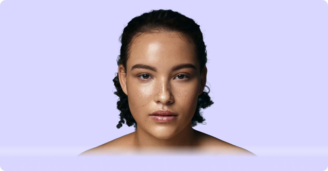 Aura — before